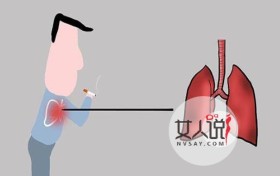 肺炎都有哪些症状，肺炎到底是怎么来的