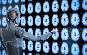 第四款医疗AI产品获批,Aidoc成为被FDA获批最多AI公司